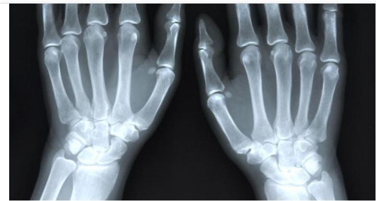 8 incredible genetic mutations & adaptat